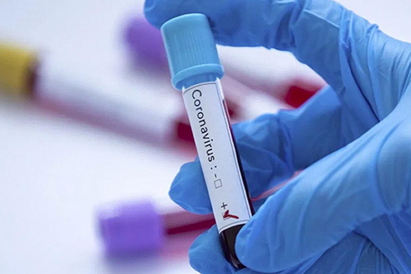 ABD'de Coronavirus nedeniyle bir günde 1105 kişi daha öldü